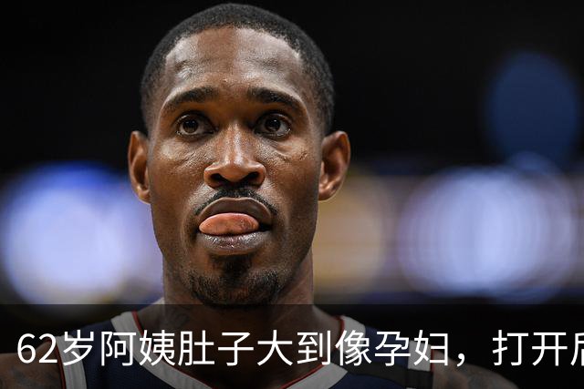 62岁阿姨肚子大到像孕妇，打开后吓坏了！巨物占满整个腹腔！深圳医生：随时大出血